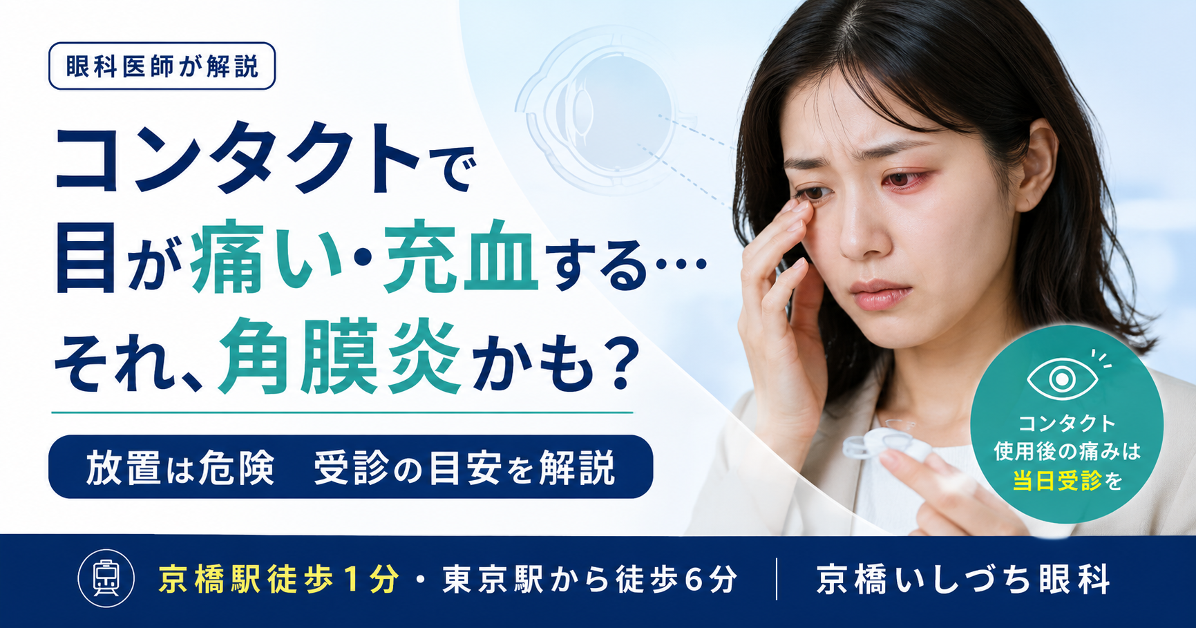 コンタクトで目が痛い・充血する…それ、角膜炎かも?放置は危険 受診の目安を解説(コンタクト使用後の痛みは当日受診を)|京橋いしづち眼科(京橋駅徒歩1分・東京駅徒歩6分)