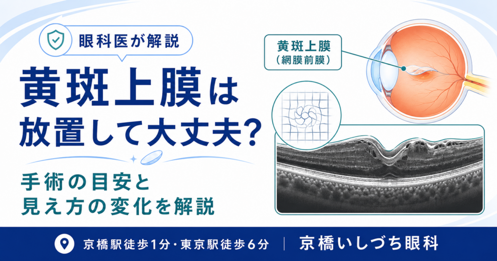 黄斑上膜は放置して大丈夫？手術の目安と見え方の変化を解説｜京橋いしづち眼科（京橋駅徒歩1分・東京駅徒歩6分）